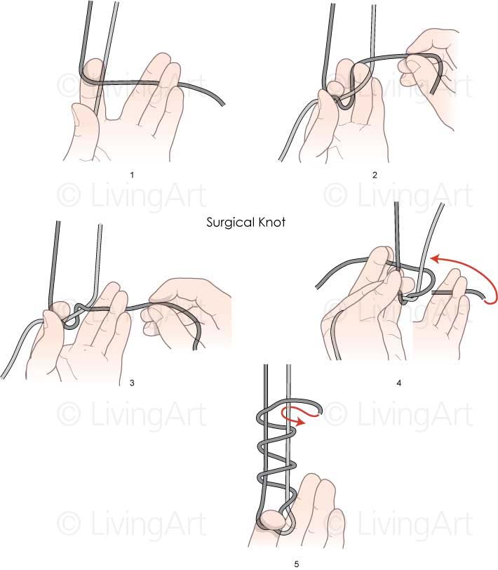 NEW-Surgical-Knot
